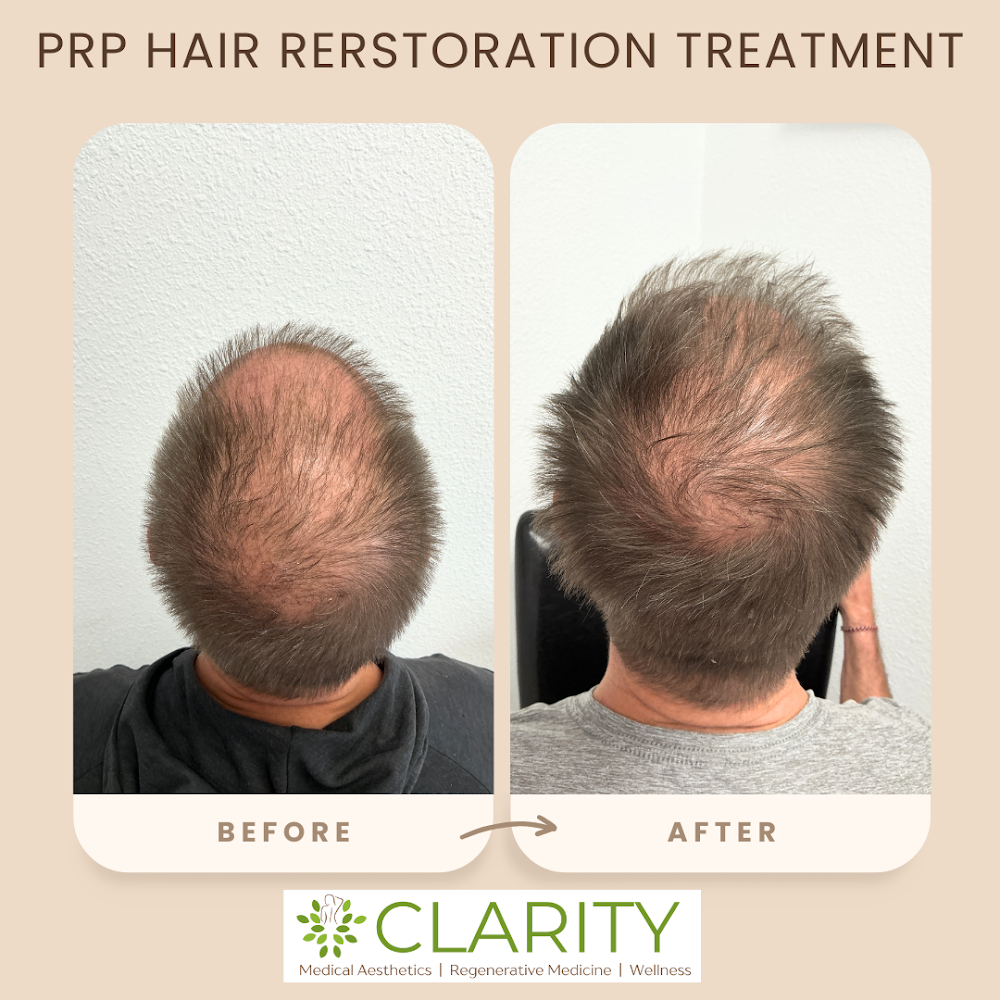 Clarity Medical Spa - San Jose, Berryessa view 2