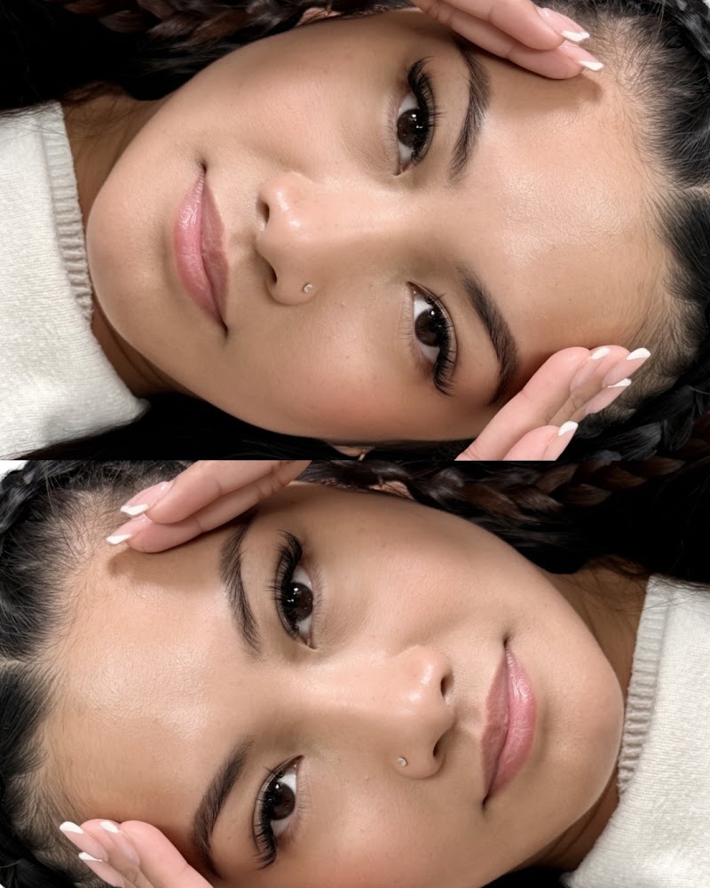 Lash Strut view 3