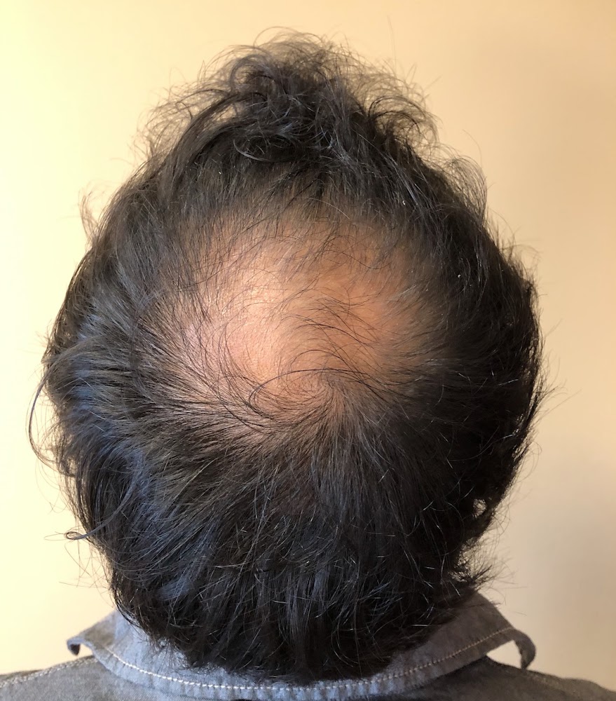 Hair Restoration Institute of DFW photo 4